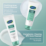 Cetaphil Gentle Clear Clarifying Acne Cream Cleanser