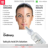 The Ordinary SALICYLIC ACID 2% SOLUTION image 1