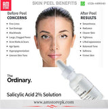 The Ordinary SALICYLIC ACID 2% SOLUTION image 1