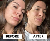 CeraVe Blemish Control Gel Moisturiser with 2% Salicylic Acid &amp; Niacinamide for Blemish-Prone Skin 40ml image 3